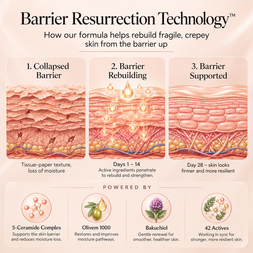 SpatGlow Anti-Stretch Mark Micro-Infusion